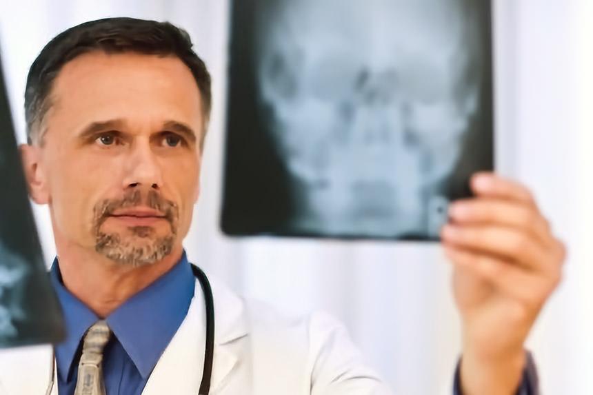 Doctor examining X-rays of the misaligned Atlas