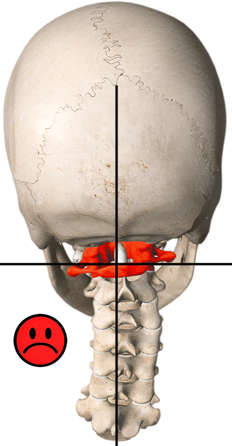 Atlas Correction