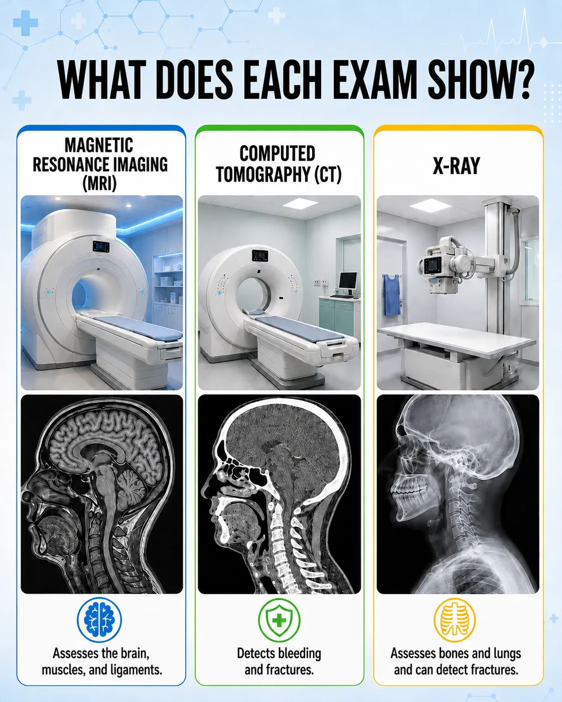 Spiral CT tomography device Spiral CT tomography device