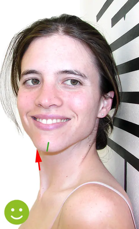 Left head rotation after Atlas realignment