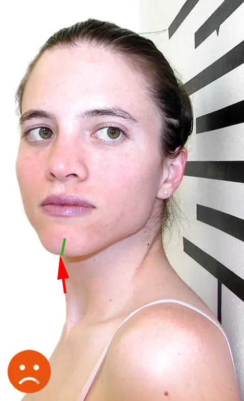 Left head rotation before Atlas realignment