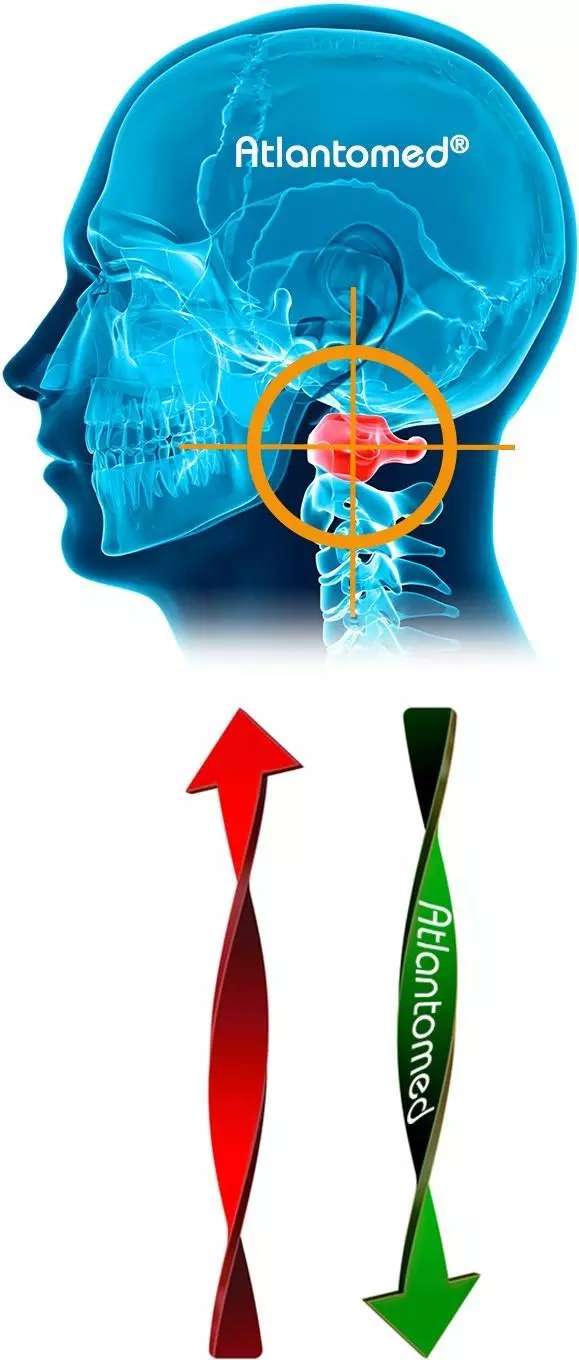 Atlas Realignment with the AtlantoMed Method