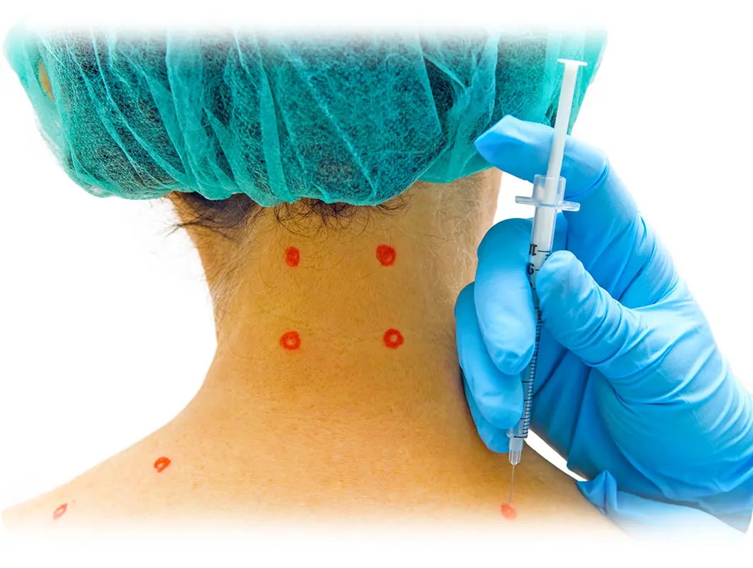 injections for muscle-tension headache