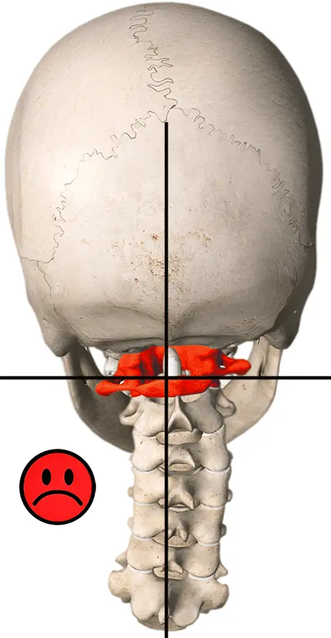 Atlas Correction
