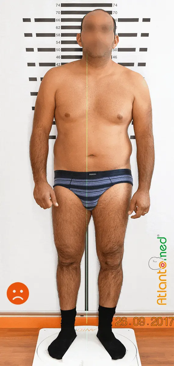 Hip and knee pain, and meniscus problems
