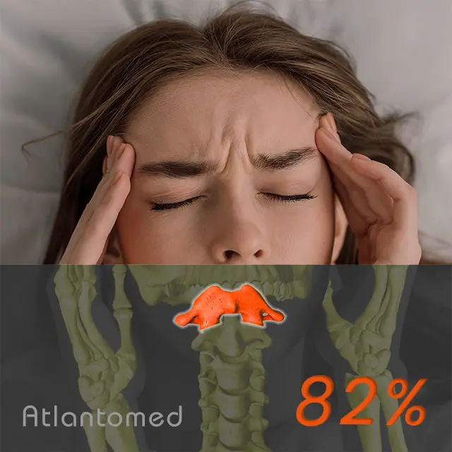 Migraine remedies