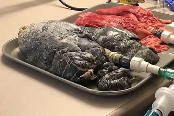 Smoked Lungs