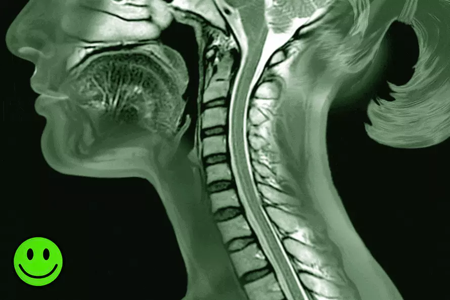 Symptoms of cervical spine straightening